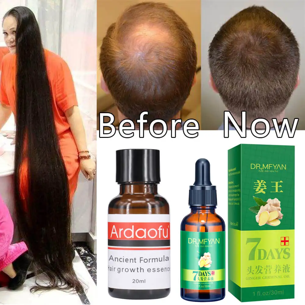 Быстрая мощная эссенция для роста волос масло против выпадения жидкая плотная