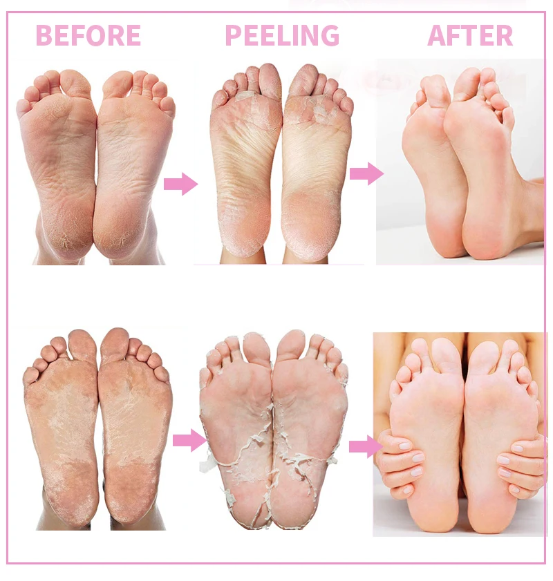 EFERO 30 упаковок в партии розового отбеливающая маска для ног пилинг удаляет