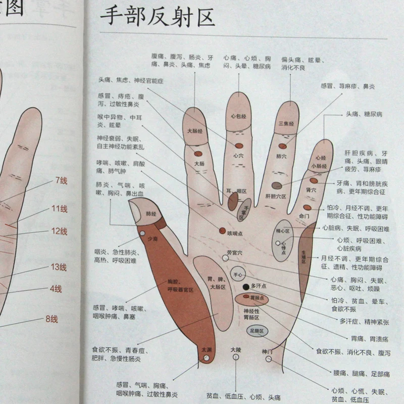 

Basic Theories Of Traditional Chinese Medicine Illustrated Human Meridians And Acupoints The Zero Foundation Health-Preserving