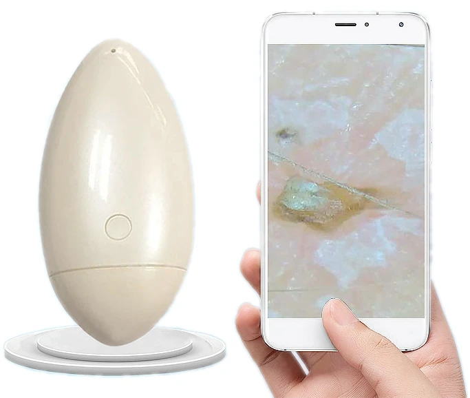 

Можно подключить к ПК/телефону/планшету HD smart wifi устройство для анализа кожи