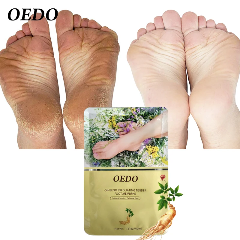 Отшелушивающая маска для ног OEDO цельный удаления омертвевшей кожи уход за ногами