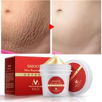 meiyanqiong smooth body cream to remove stretch marks scar for pregnant woman postpartum care repair maternity skin cream myq022