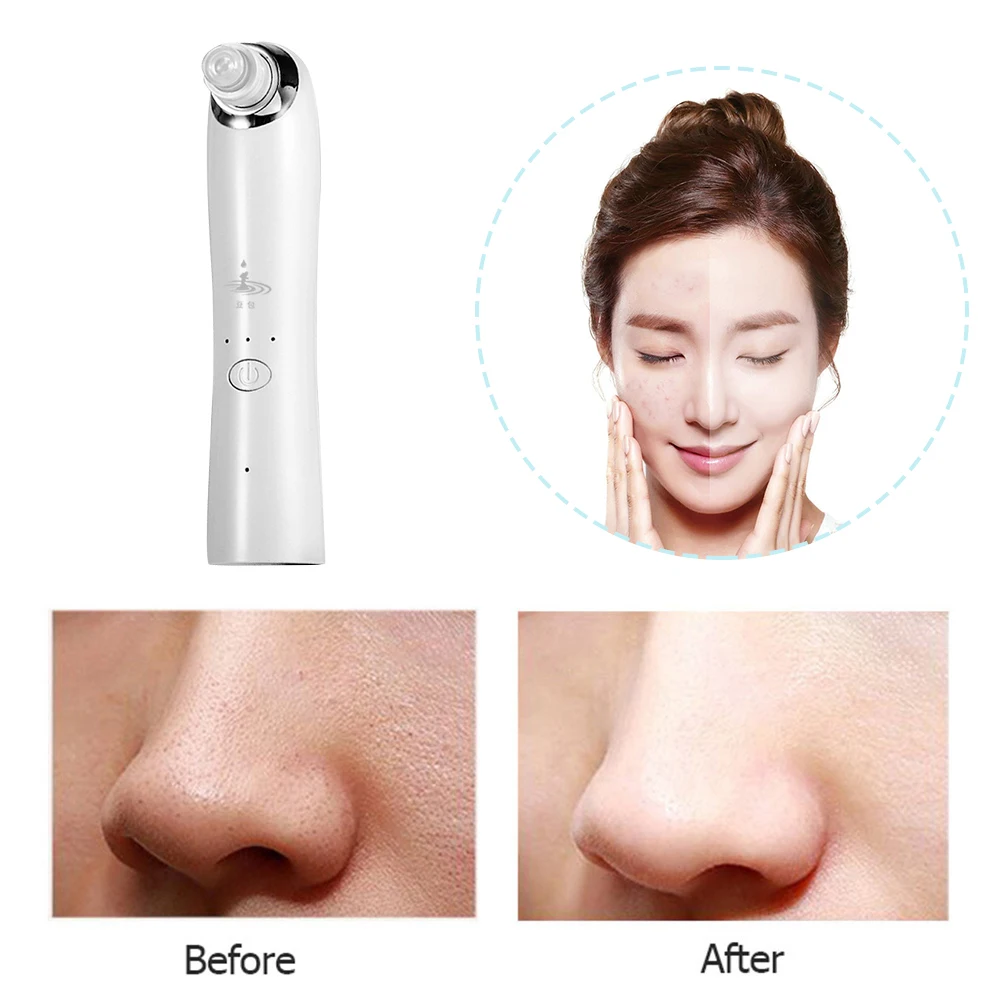 

Electric Blackhead Remover Vacuum Pore Acne Pimple Dead Skin Face Nose Cleaner Face Deep Cleansing Skin Care Machine Dropship