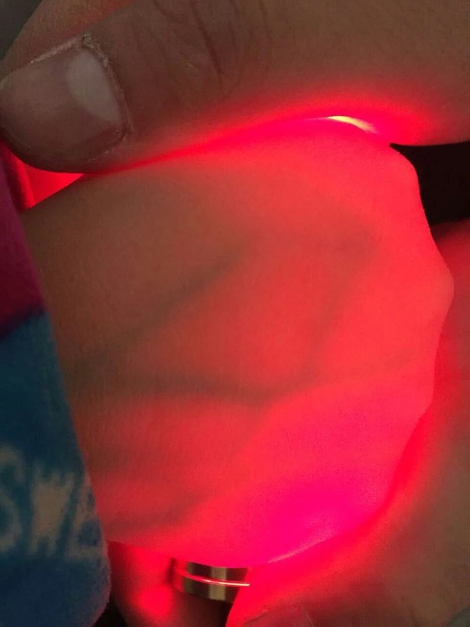 Характеристическая вязкость полимера вены просмотра 6 медицинская визуализация