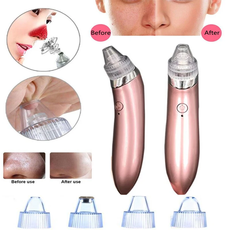 Вакуумный Электрический Очиститель пор от угрей для удаления лица Msaager USB