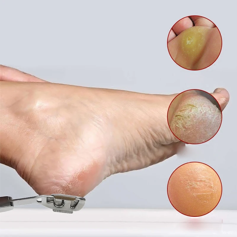 Бритва для кожи ног средство удаления мозолей и кутикулы 10 лезвий|Инструмент