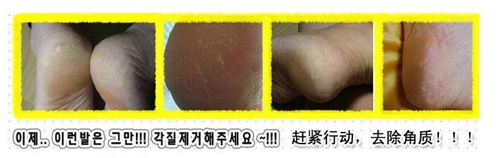 Нержавеющая сталь щетка для стоп ороговевшей кожи средство удаления костных