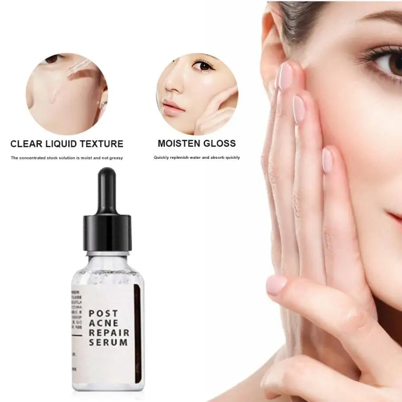 

EELHOE Acne Serum Face Serum Repair Anti-Acne Moisturizing Acne Marks Repair Serum Dry Rough Skin Whitening Skin Care TSLM1