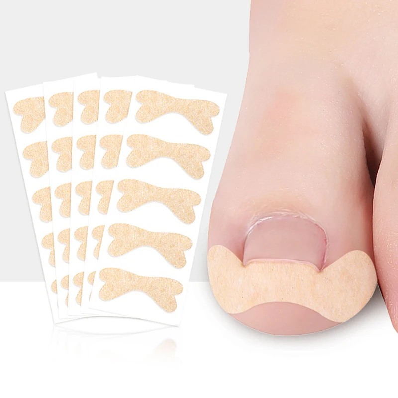 

2PCS Ingrown Toenail Corrector Sticker Paronychia Treatment Fixer Recover Corrector bunion Pedicure Foot Toe Nail Care Tool
