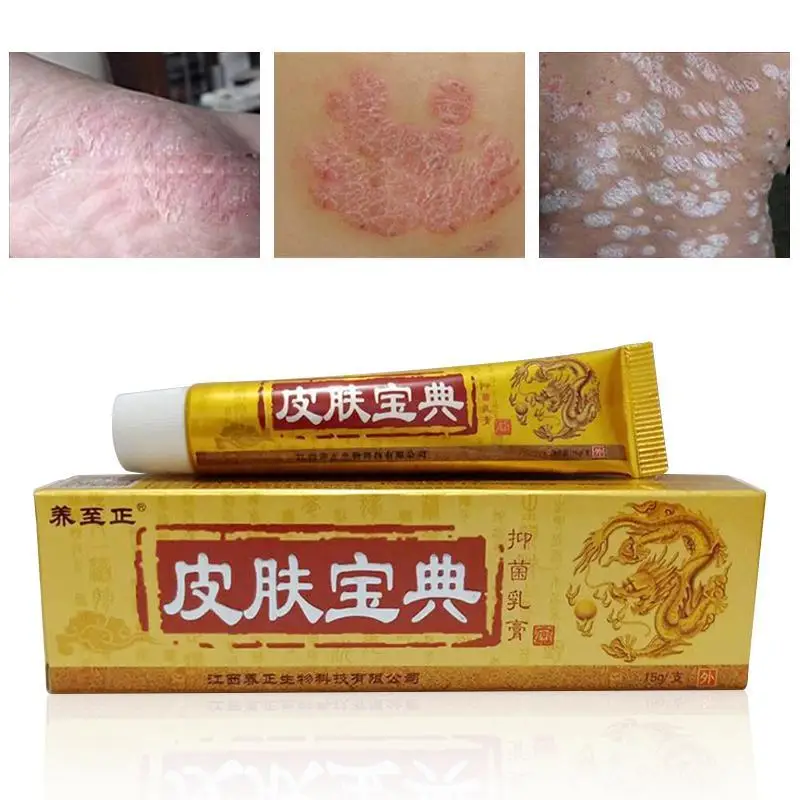 

1pc 15g Original Psoriasis Cream Dermatitis Eczematoid Eczema Ointment Skin Pruritus Psoriasis Treatment Body Massage Skin Care
