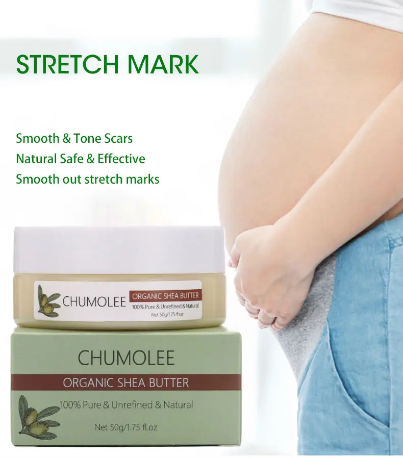 Крем Для Удаления растяжек Chumolee с нерафинированным маслом Ши устранение шрамов