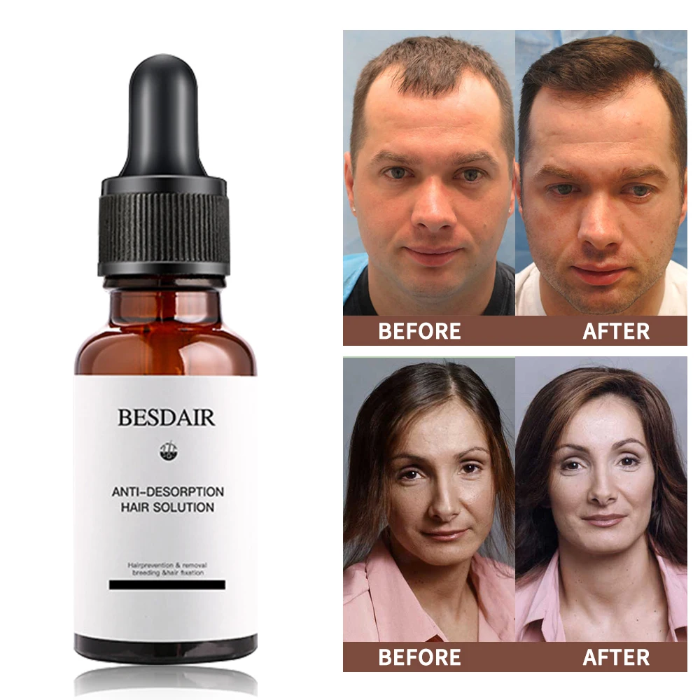 Hair Growth Essence Oil Anti Hair Loss Products for Hair Growth Treatment Genger Natural Serum Hair Thickener Care Solutions
