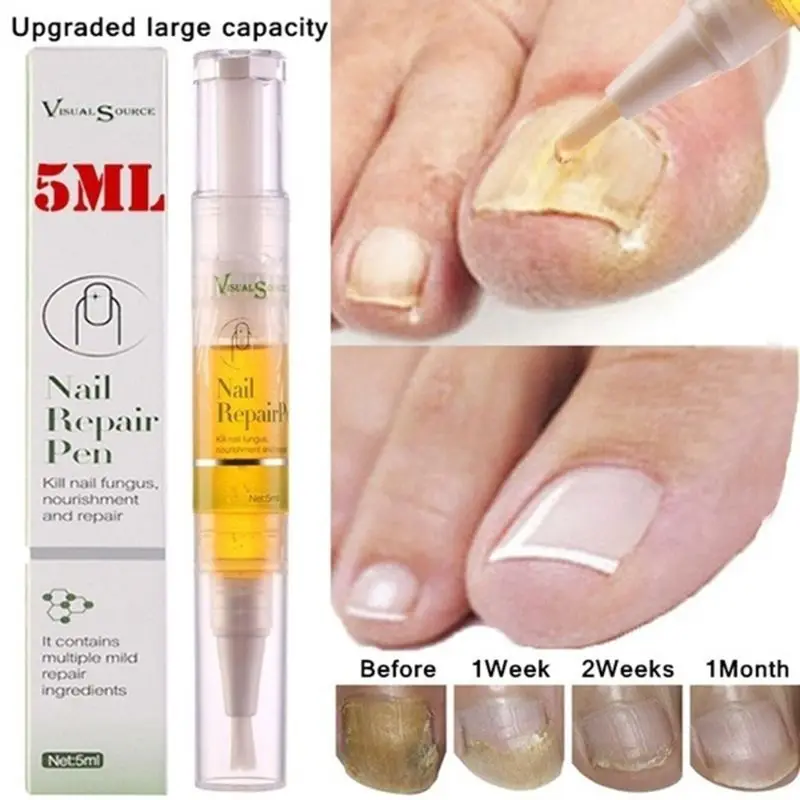 5 мл гели для ногтей питательных веществ ручка удаляет грибок жидкость ремонта
