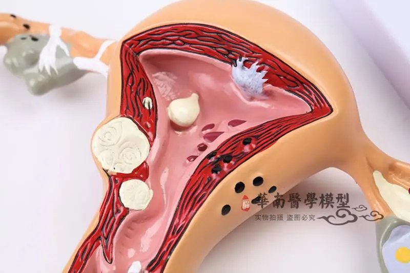 Модель женской анатомии модель репродуктивной матки вагинальный яичников форма