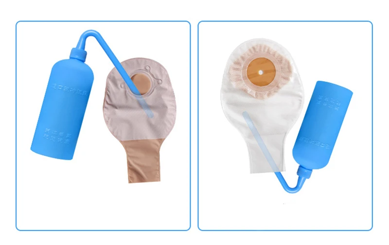 Ostomy Bag Flushing Pot Stool Bag Anus Bag Flushing Bottle Ostomy Bag Flushing Device Stoma Care Products Cleaning And Cleaning
