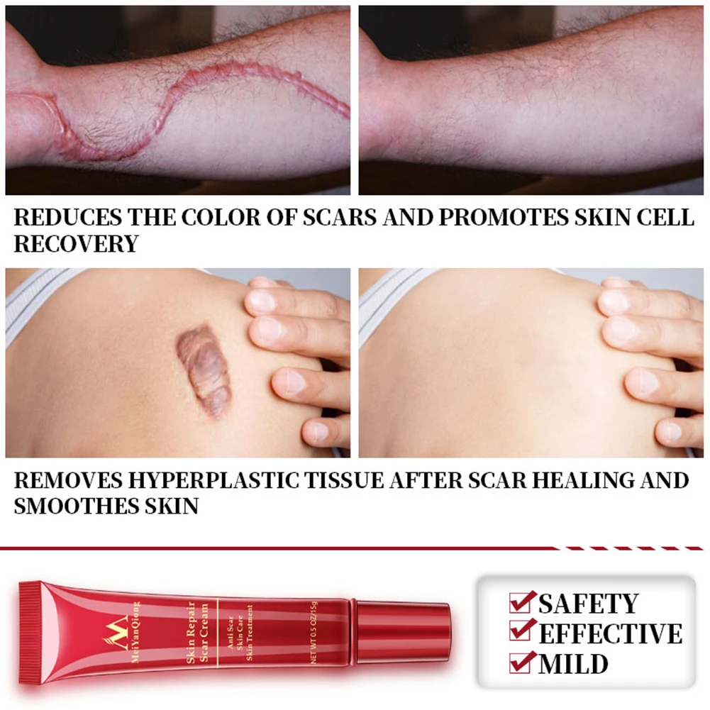 

MeiYanQiong 15g Anti Scar Removal Face Treatment Cream Repair Essence Anti-Inflammatory Repairing Skin Ginseng Essence Skin Care