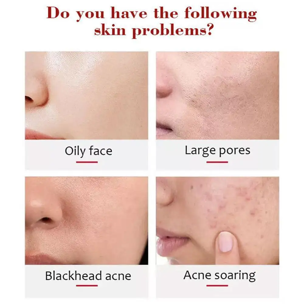 

Beauty Fruit Exfoliating Cream Scrub Peeling Body Hand Body Face Cream Face Skin Care Gel Moisturizing Whitening I1Q5