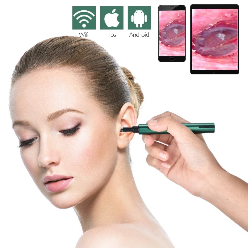 

Беспроводной Wi-Fi Otoscope ультратонкая камера для ушей водонепроницаемый инструмент для удаления ушных восков светодиодный инструмент для ухо...