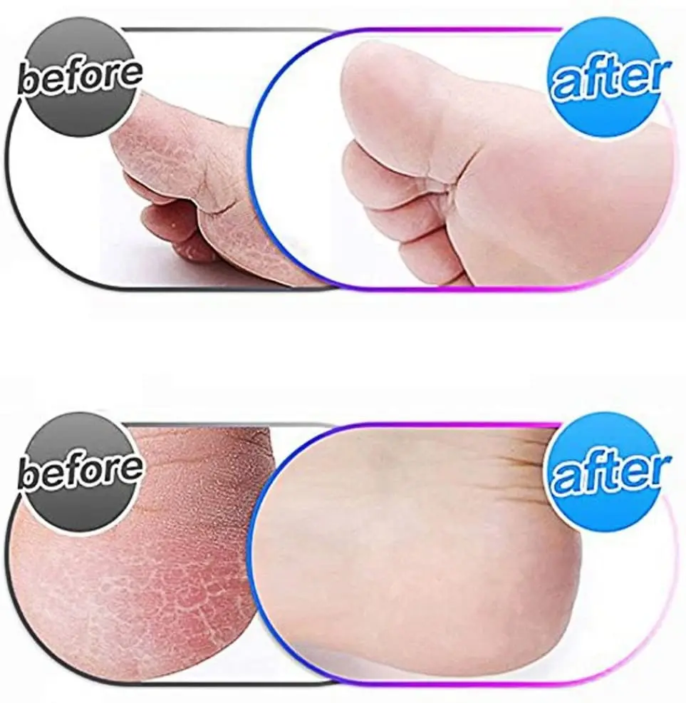 

8pcs Replacements Roller Heads for Pro Pedicure Foot Care for Feet Electronic Foot File Rollers Skin Remover Accessories