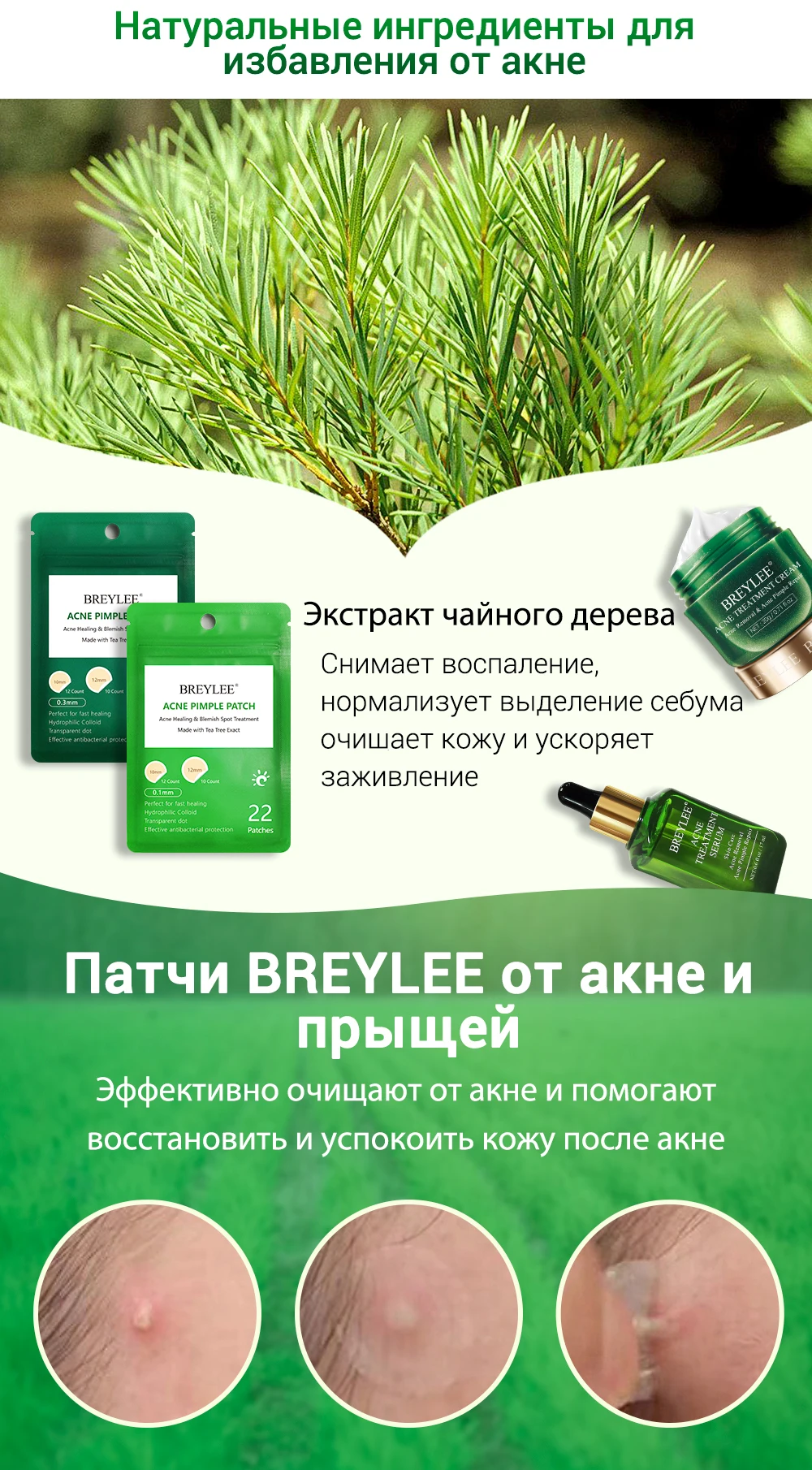 Breylee маска для лица крем для лица сыворотка для лица от прыщей лечение акне Сыворотка для ухода за кожей лица Маска Крем против акне крем отбеливающий крем маски для лица устройство для удаления прыщей инструменты