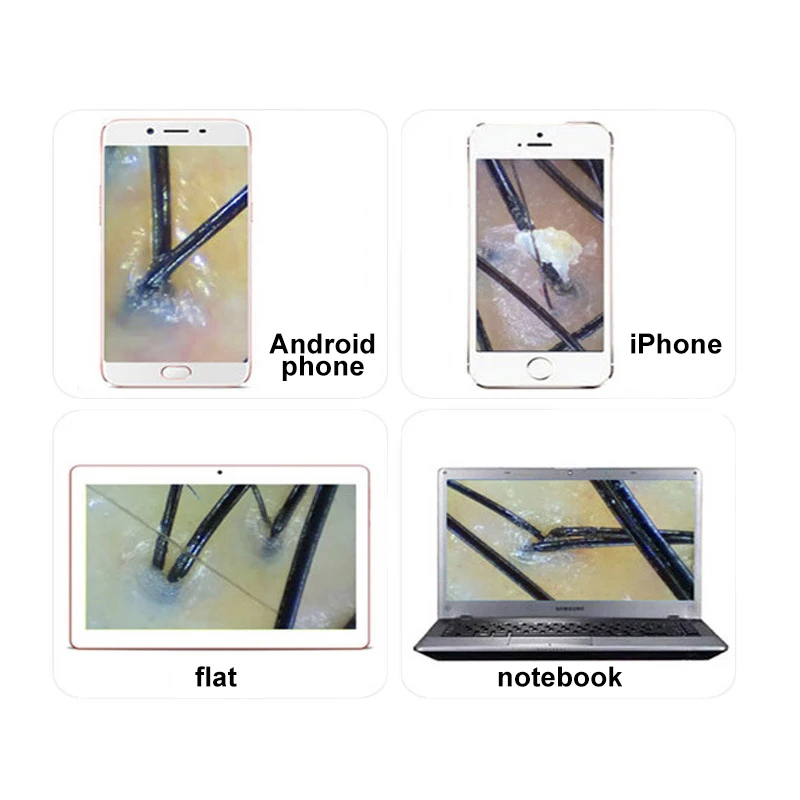 wireless wifi mobile phone ipad scalp hair follicle skin detector hair analyser machine for hair skin care free global shipping