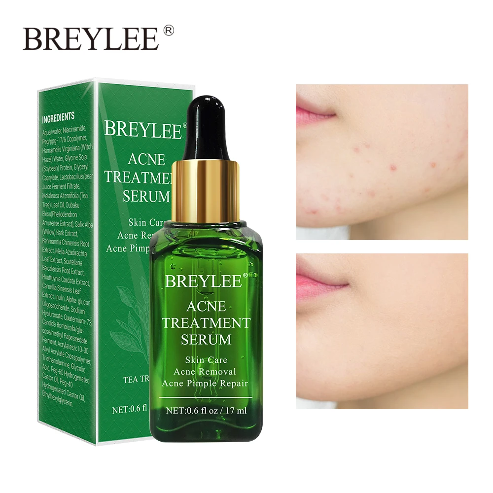 

BREYLEE Tea Tree Acne Treatment Face Serum Essence Reduce Acne Scars Oil Control Moisturizer Brighten Shrink Pores Beauty Liquid