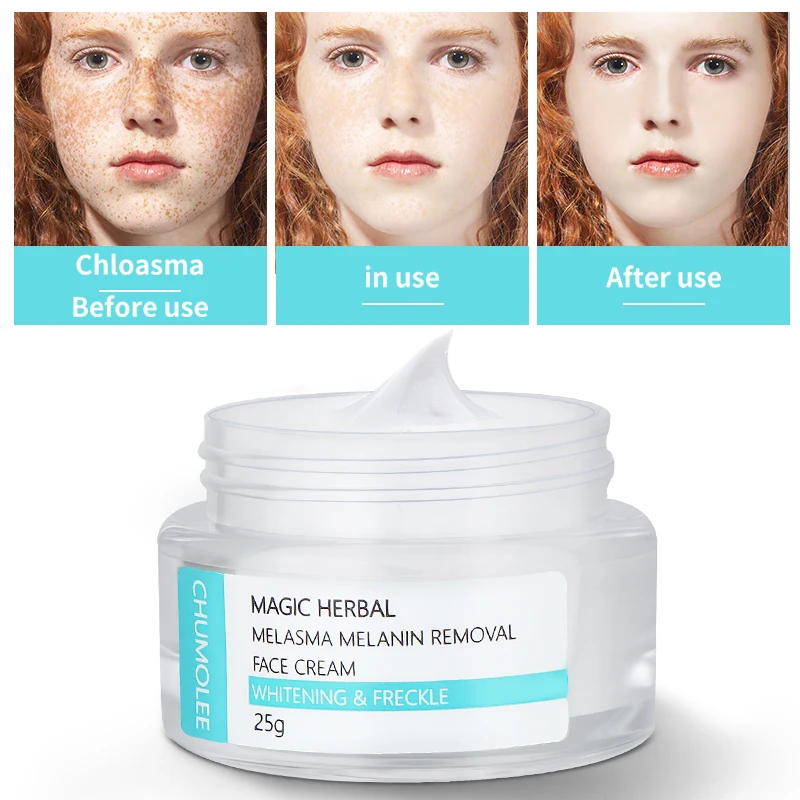 Мощный отбеливающий крем Chumolee 25 г для удаления веснушек пятен мелазмы пигментных