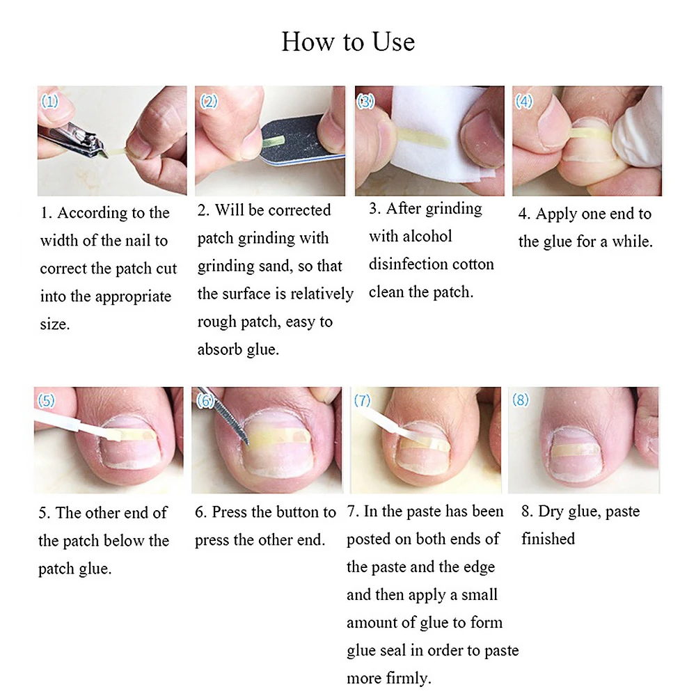 100 шт/8 Размер вросших ногтей выпрямляющий пластырь для ног Уход за ногами