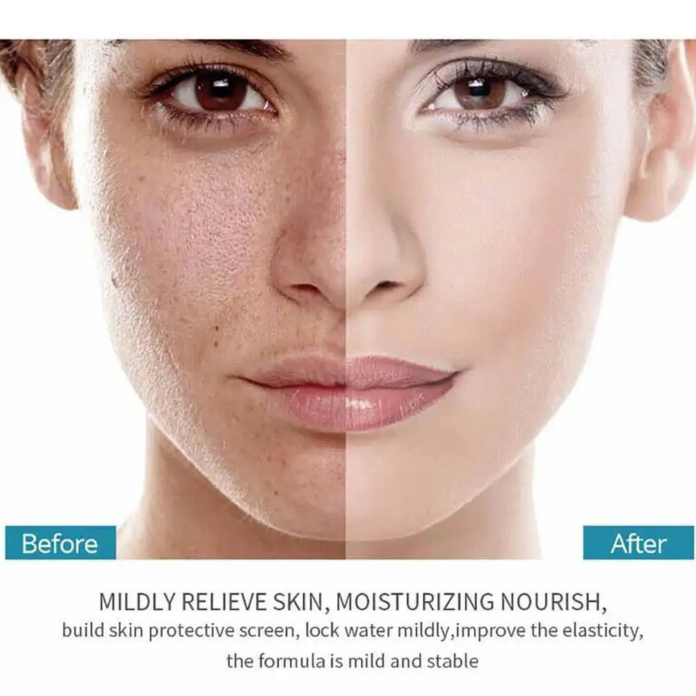 

Vitamin A Alcohol Hyaluronic Acid Essence 2mlX15 Branches Moisturizing Moisturizing Repairing Essence Smoothing And Skin D6I8