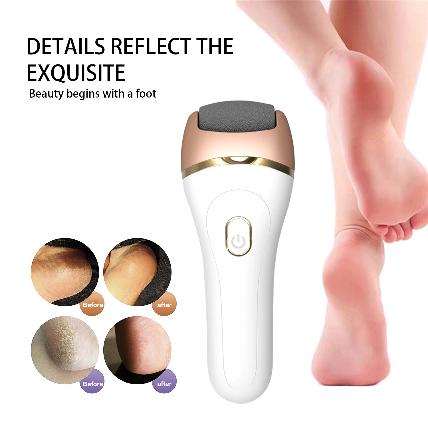 

3 IN 1 Electric Callus Remover Feet Dead Skin USB Rechargeable Foot File Pedicure Tools IPX7 Waterproof Pedicure Kit Tools