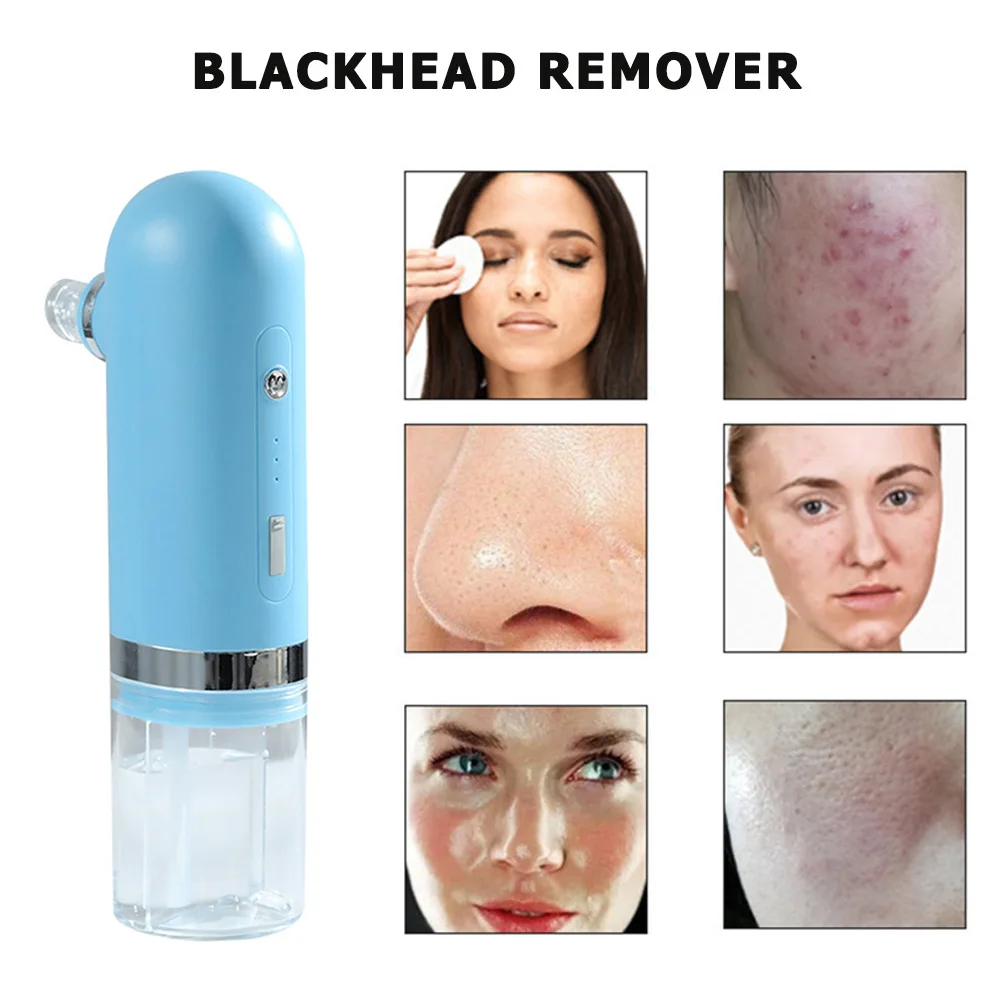 Вакуума для удаления угрей глубокое очищение всасывания Электрический