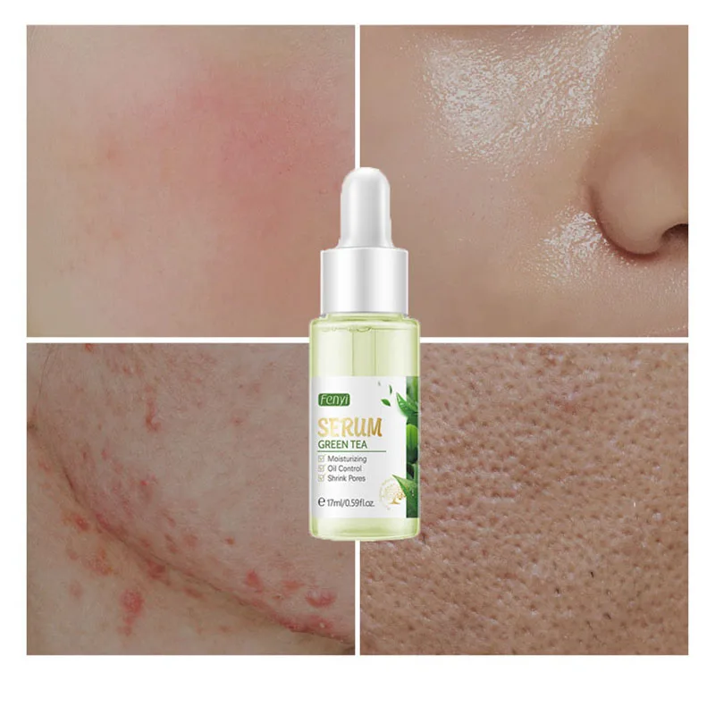 

Green Tea Acne Treatment Serum Remove Acne Spots Oil Control Shrink Pores Deep Moisturizing Skin Soothing Repairing Face Essence