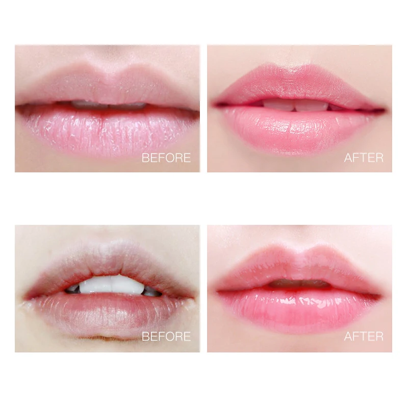 12/10/8 шт. Коллагеновые патчи для губ |