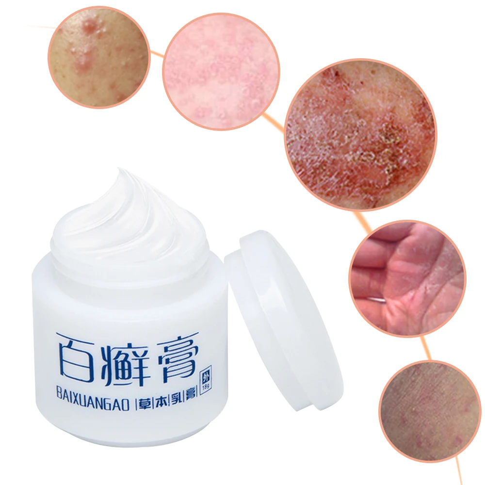 

Eczema Cream Dermatitis Psoriasis Antibacterial Ointment Anti-itching