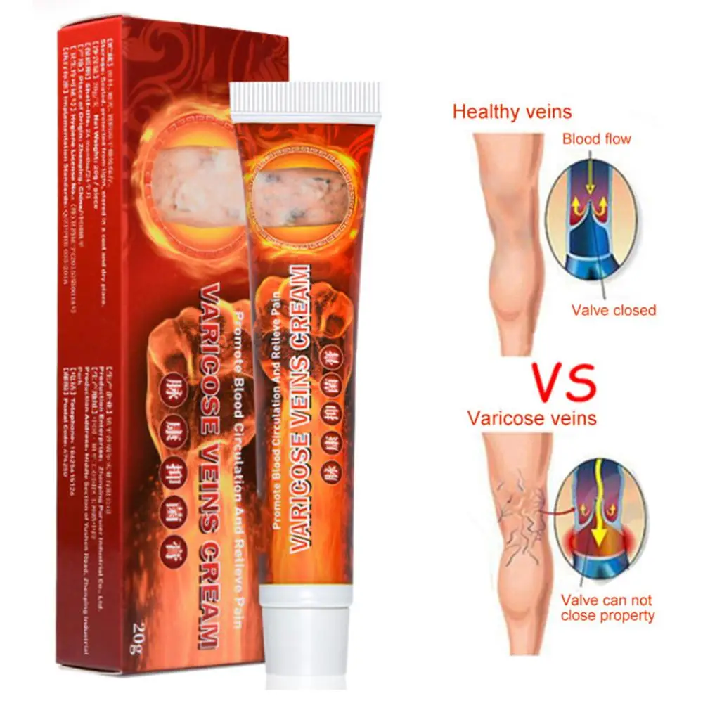 20g Varicose Veins Treatment Cream Herbal Vasculitis Phlebitis Pain Relief Angiitis Inflammation Rotten Legs Ointment Foot Care | Красота и