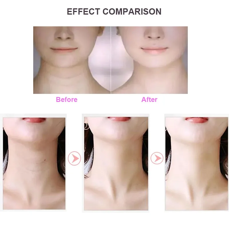 

Neck Face Massager LED Photon Therapy Reduce Wrinkles Ultrasonic Vibration Roller Beauty Products USB Charging Skin Care Tool