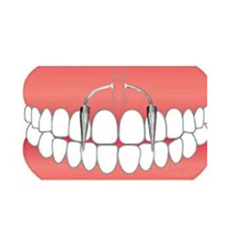Titanium Steel Dracula Nail Septum Piercing Tiger Tooth C Rod Smile Lip Zomibe Vampire Jewelry | Дом и сад