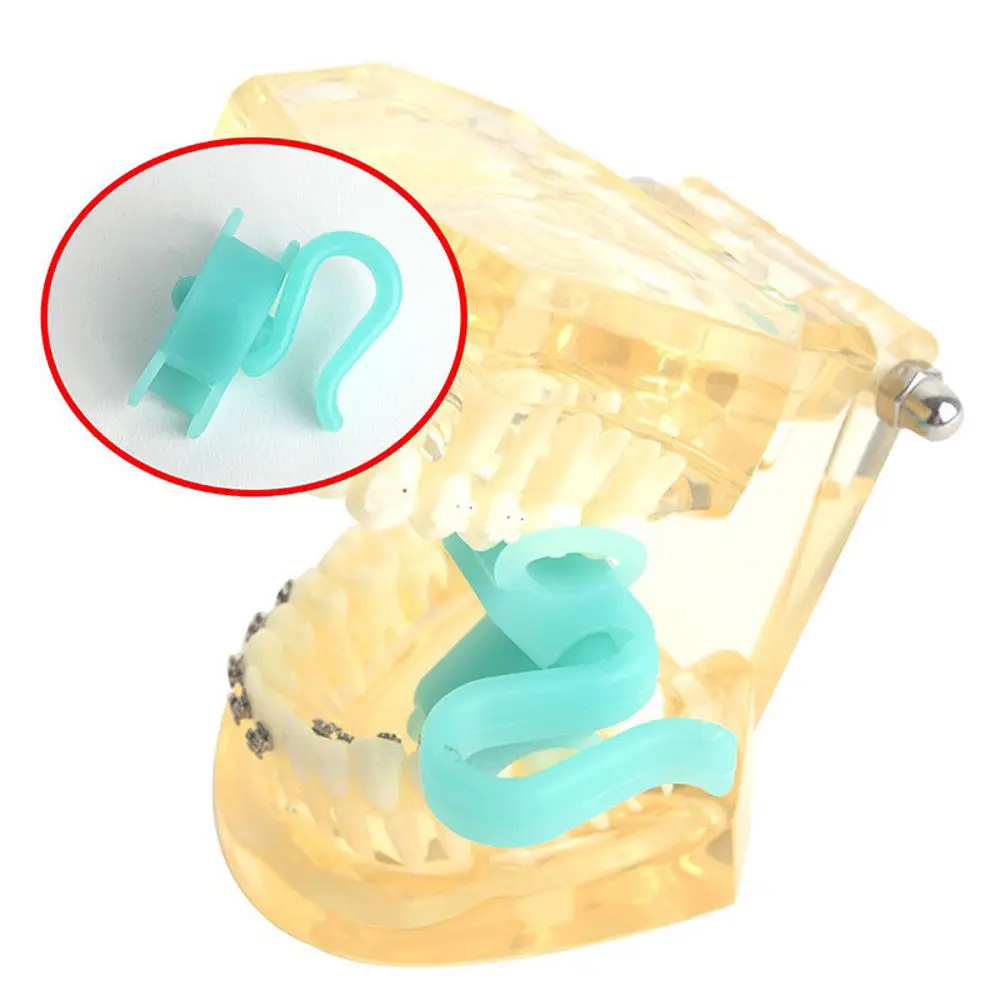 Интраоральное поддерживающее устройство для ротовой полости 2 размера Ретрактор