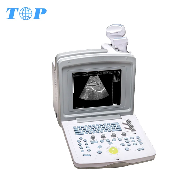 

TOP-A1004 China latest factory price portable cardiac ultrasound machine