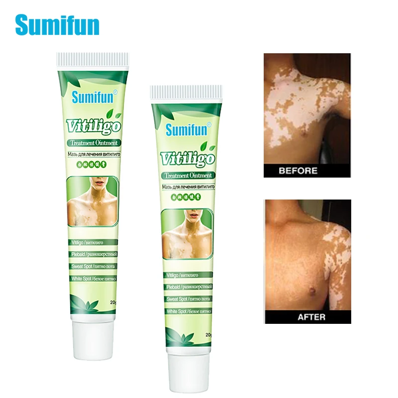 

Sumifun 20g VitiligoTreament Cream Antibacterial Cream Psoriasis Localized Vitiligo Ointment Whitespot Mycosis Leukoplakia Treat