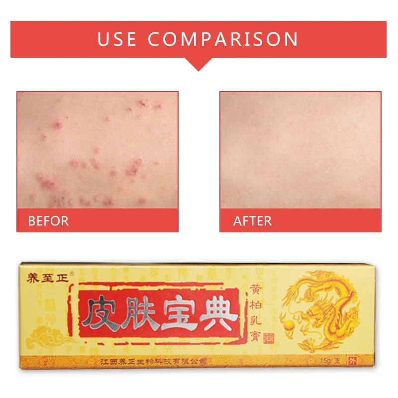 

Original Chinese medicine cream psoriasis dermatitis eczema itching relieve skin itching body ointment psoriasis cream