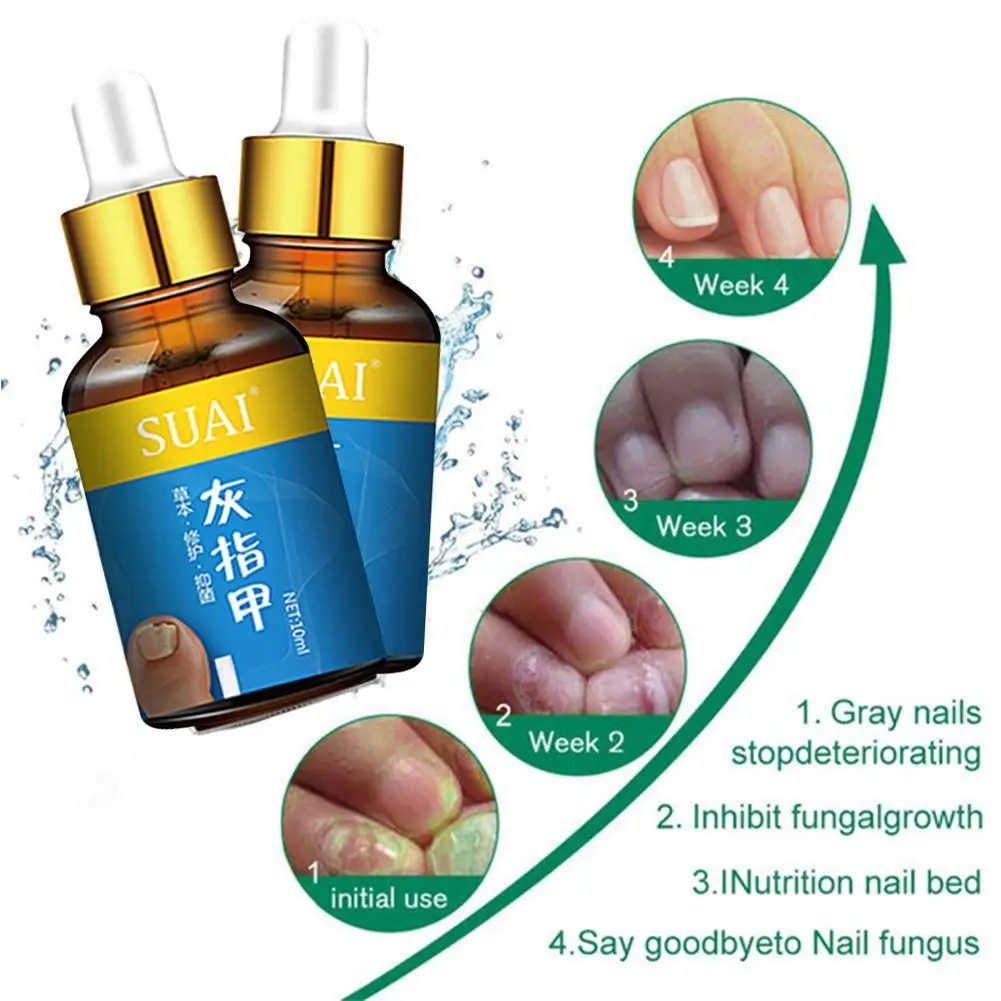 

1Pcs Nail Fungal Treatment Serum Onychomycosis Paronychia Foot Nail Anti Infection 10ml Repair Care Essence Nail Toe Anti-F X1E8