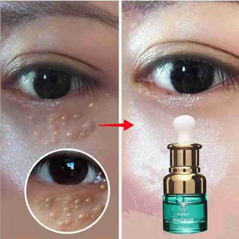 

20ml Lighten dark circles in 7 days remove eye bags fat particles Eye Serum Anti-Wrinkle eye skin care cream Anti Puffiness