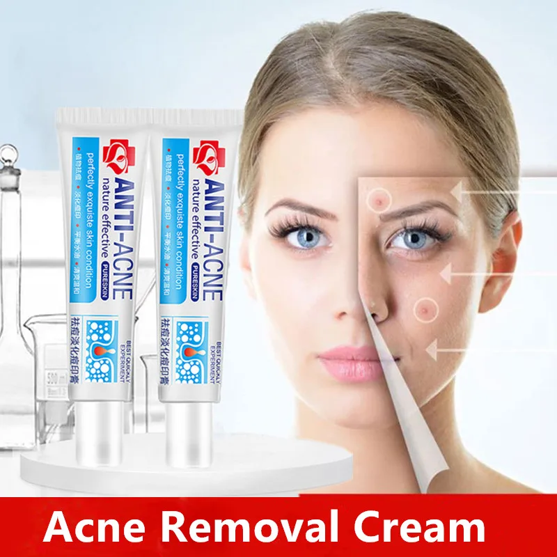 

Effective Acne Removal Cream Acne Treatment Fade Acne Spots Oil Control Shrink Pores Whitening Moisturizing Acne Cream Skin Care