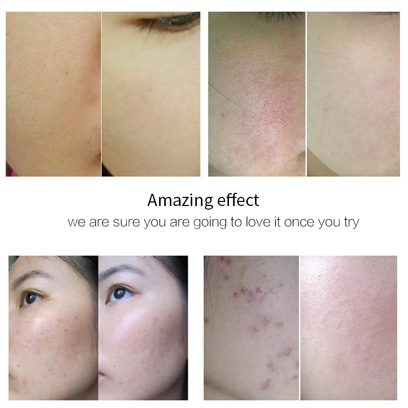 100 шт лососевая капсула с эссенцией Омолаживающая восстанавливающая отбеливание