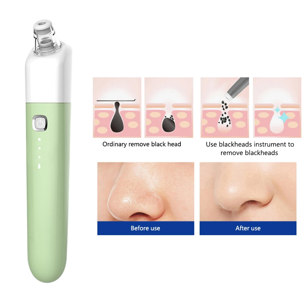 

Personal Care Appliances