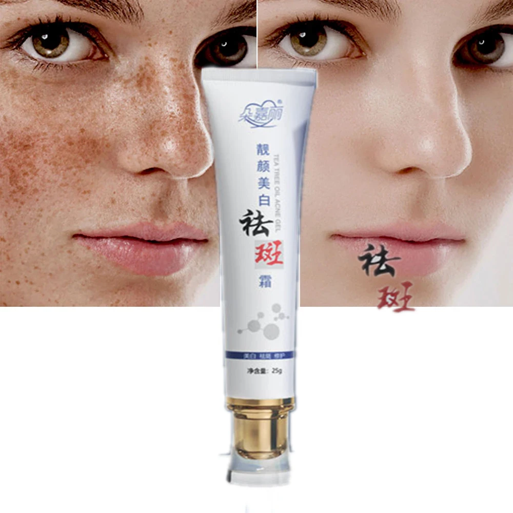 Effective Whitening Freckle Cream Remove Melasma Acne Spot Pigment Melanin Dark Spots Pigmentation Moisturizing Gel Skin Care | Красота и