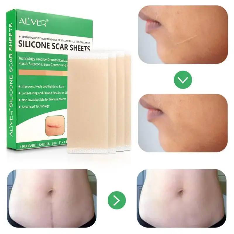 

Silicone Surgical Scar Removal Patch Remove Trauma Burn Sheet Skin Repair Scar Removal Therapy Patch For Acne Scar Treatment