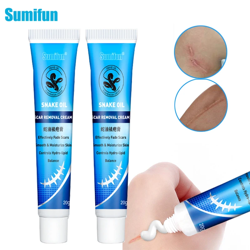 2 шт. 20g старый лечение шрамов Ластик Крем для удаления ожоги режет мощный стрейч