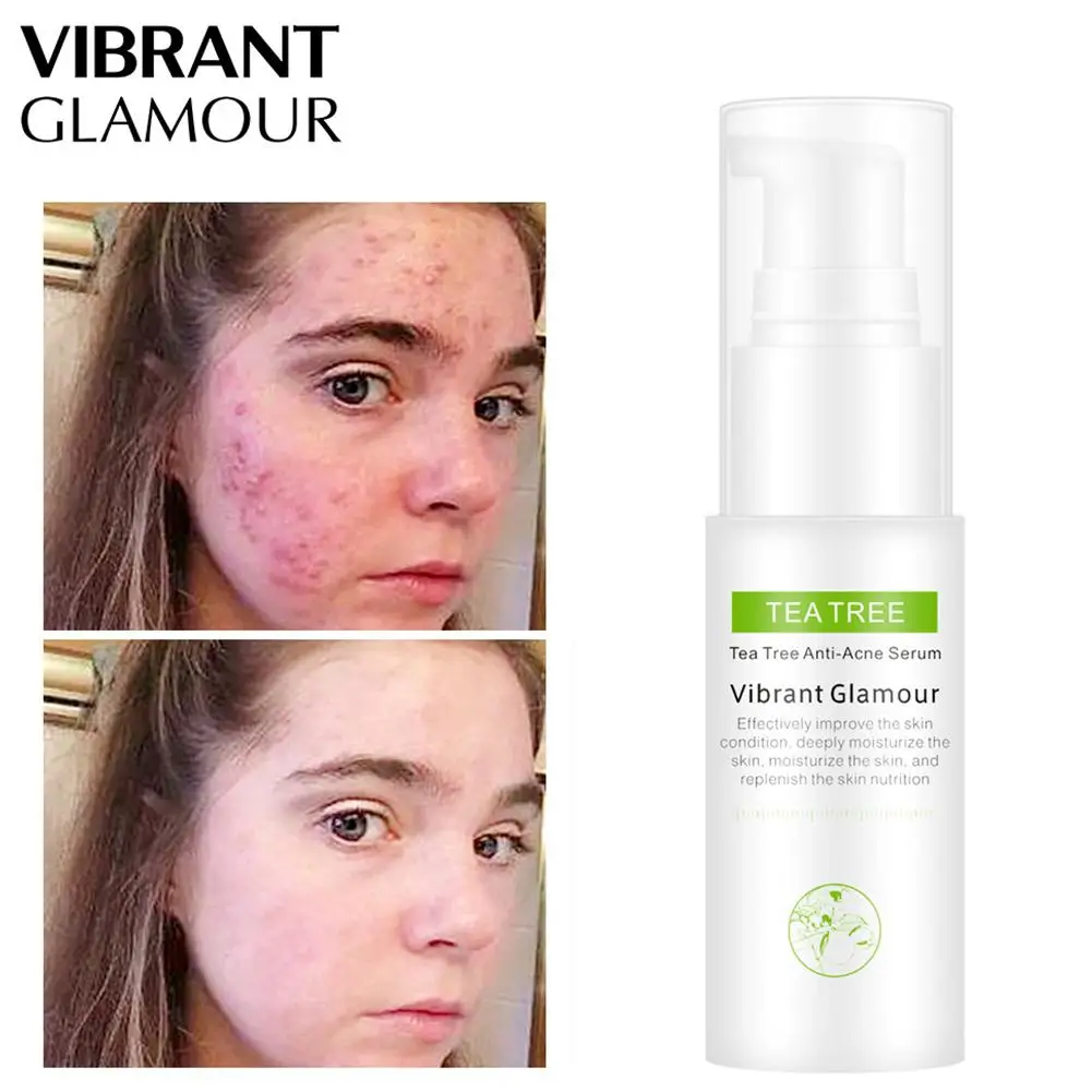 Яркий гламурный Тонер для чайного дерева термоусадочная вода удаления угрей